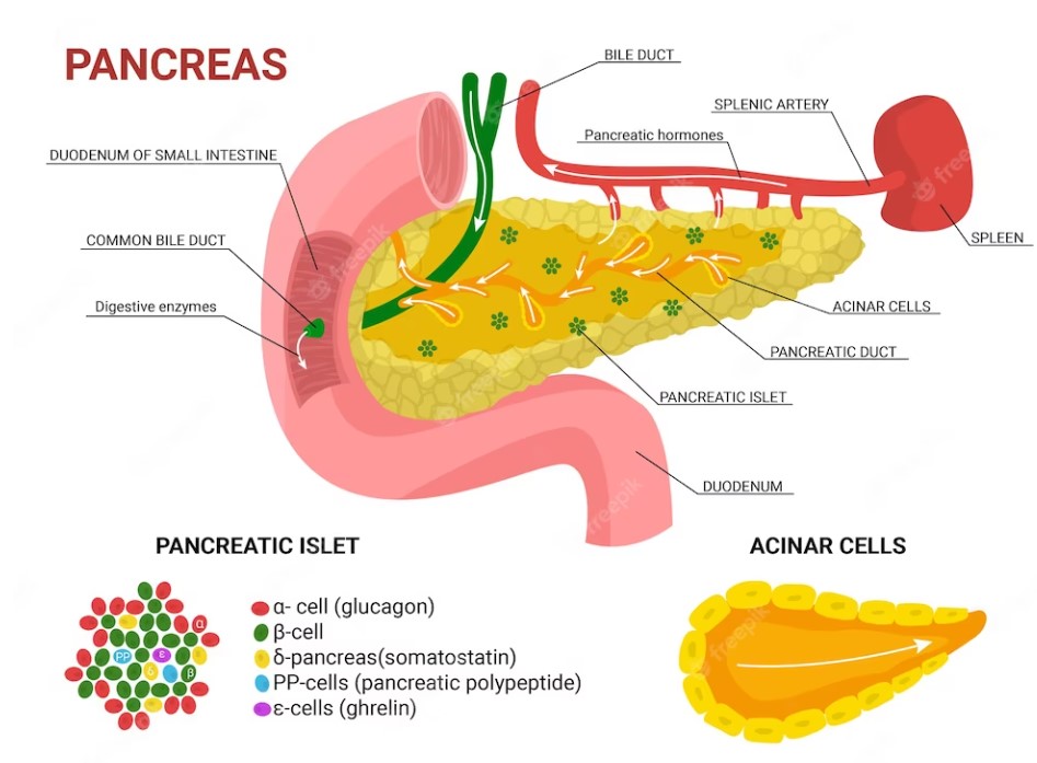 pancreatic cancer